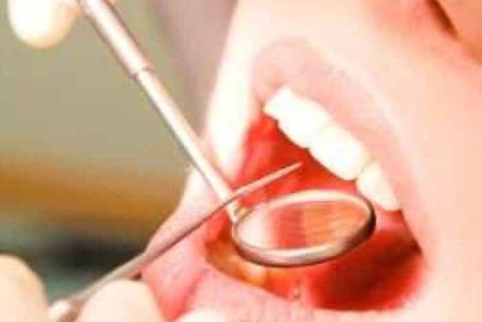 MCZoYXNoPTM4MjIxMjE0OTdhMGZjZGE3ZDZjZGUxMWUxZTliMDQw.thumb_