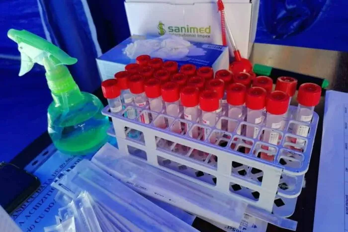Teste-anticoronavirus-covid-19-4-e1597753777615