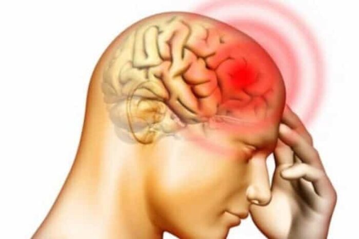 Reţele din creier ce joacă un rol crucial în riscul de suicid accident vascular cerebral