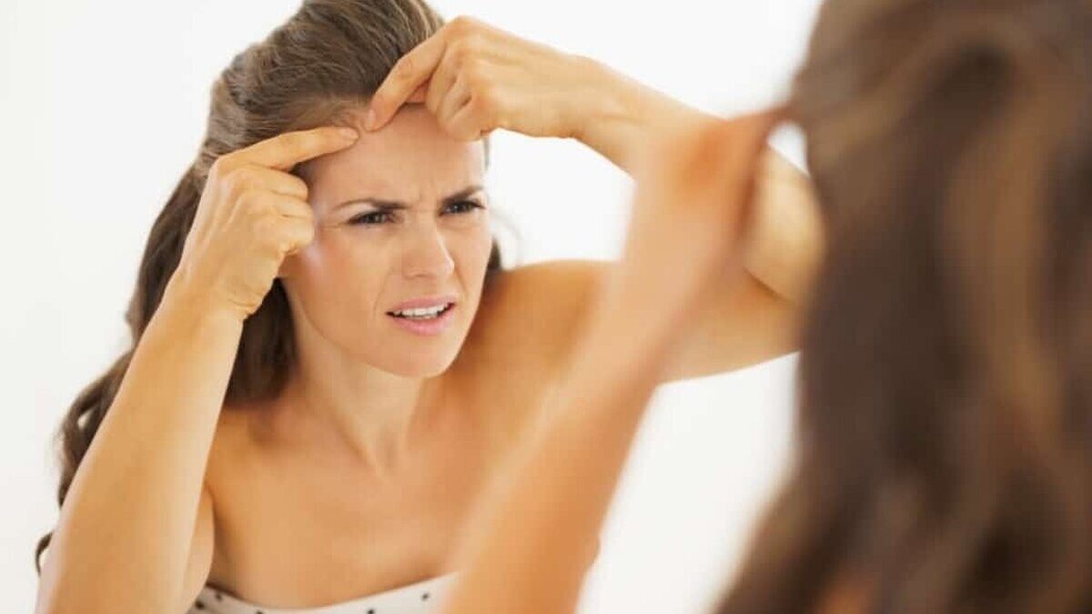 5 moduri simple prin care poți să scapi de punctele negre acnee 1 1