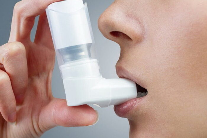 astm bronsi 26012019