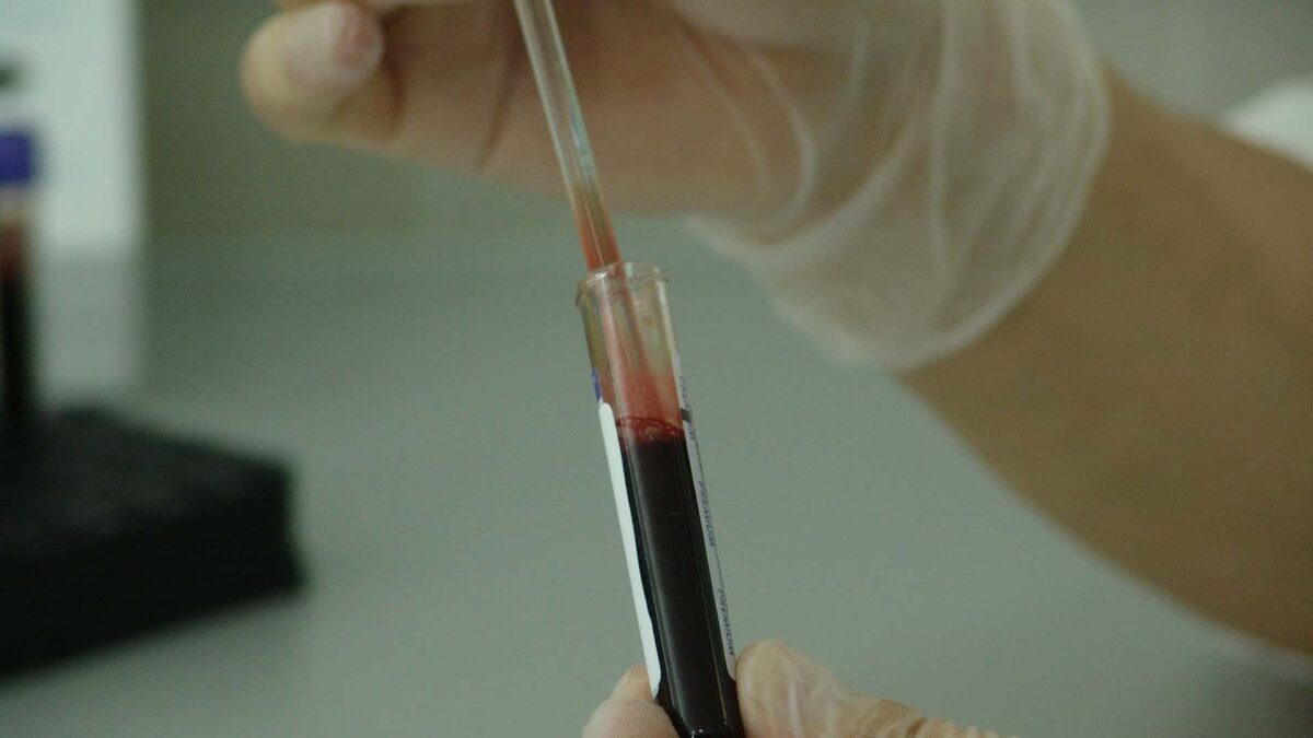 blood-20745_1920-1