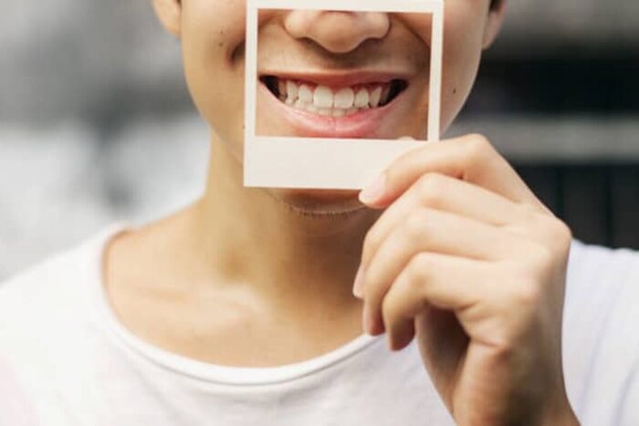 implanturi dentare