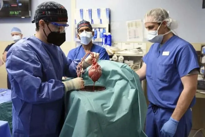 transplant-inima-porc