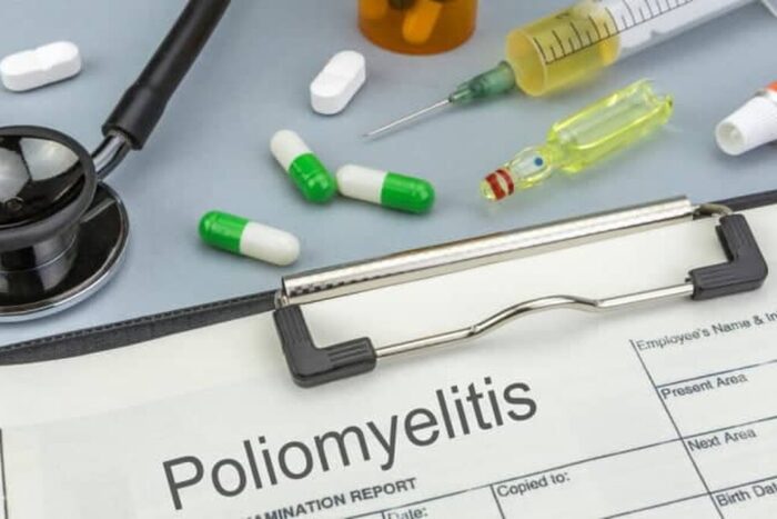 poliomielita
