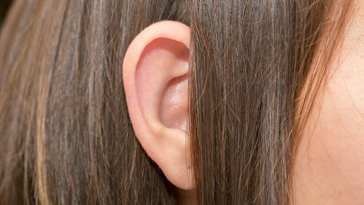 Ears,Protruding,From,Under,The,Hair,,Otolaryngologist,Treatment,Of,Diseases