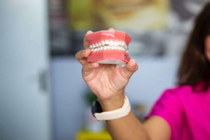 implant dentar