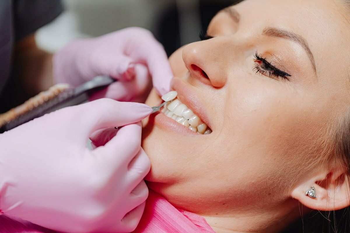 Patru tipuri de tratamente de cosmetică dentară şi când sunt recomandate