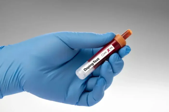 test antidoping 1024x683 1