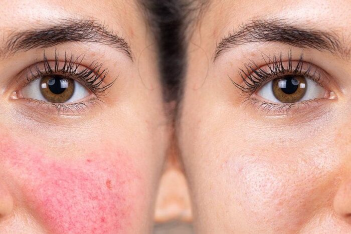 cosrx snail mucin skincare