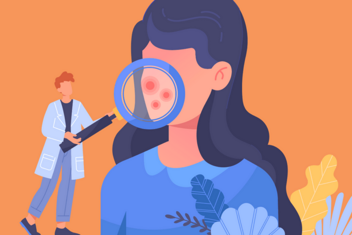 Cum se schimbă psoriazisul pe măsură ce femeile îmbătrânesc Cum se schimba psoriazisul pe masura ce femeile imbatranesc