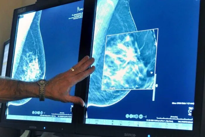 09mammograms-sb-facebookJumbo.jpg