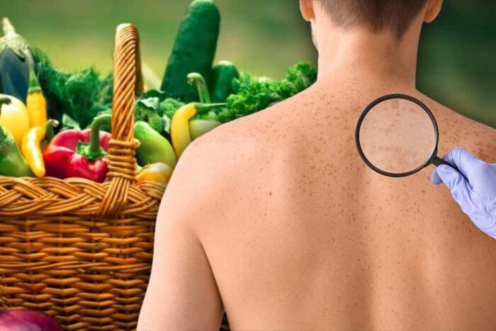 Legumele si fructele din bucatarie care te scapa de petele