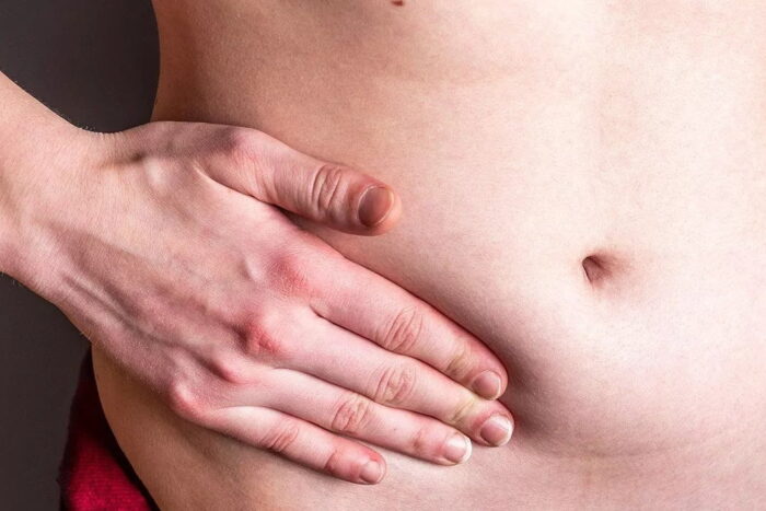 poze-cu-hernie-abdominala-1