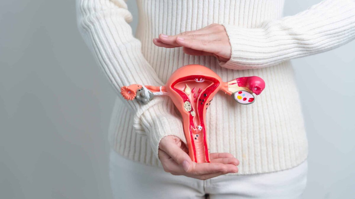 fibromul-uterin