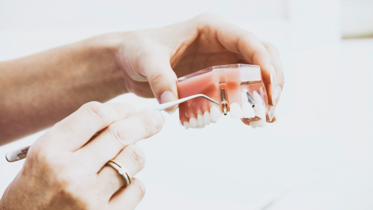 implant dentar Elveto Dent