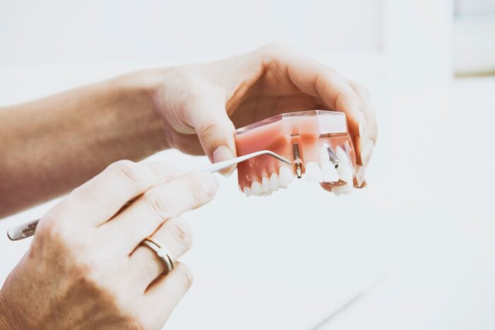 implant dentar Elveto Dent