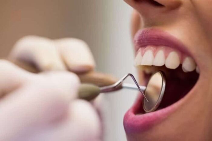 Cum poți preveni apariția afecțiunilor dentare 4 măsuri eficiente