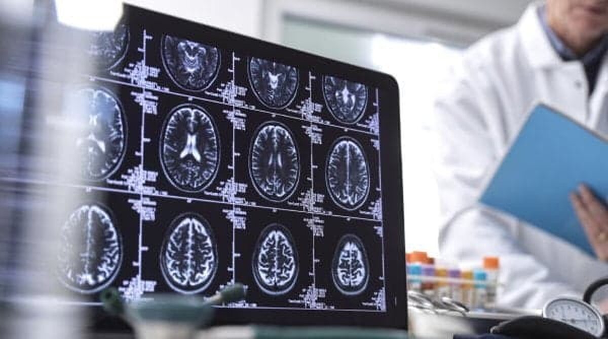 De ce companiile europene nu se înghesuie să îşi ajute angajații să învețe să lucreze cu inteligenţa artificială?