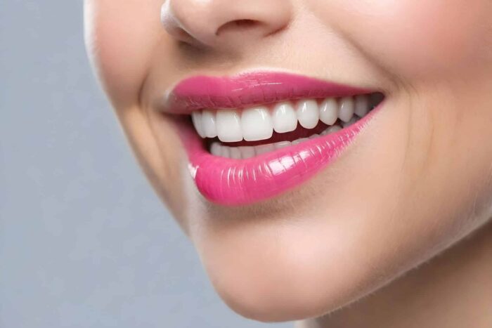 fatete dentare