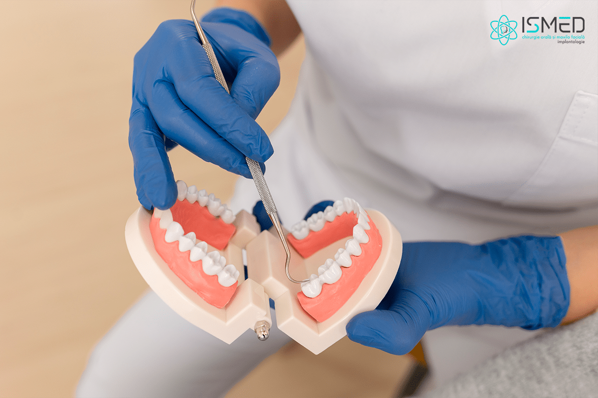 Ați putea avea un chist dentar și nu știți încă – când este necesară chistectomia dentară?