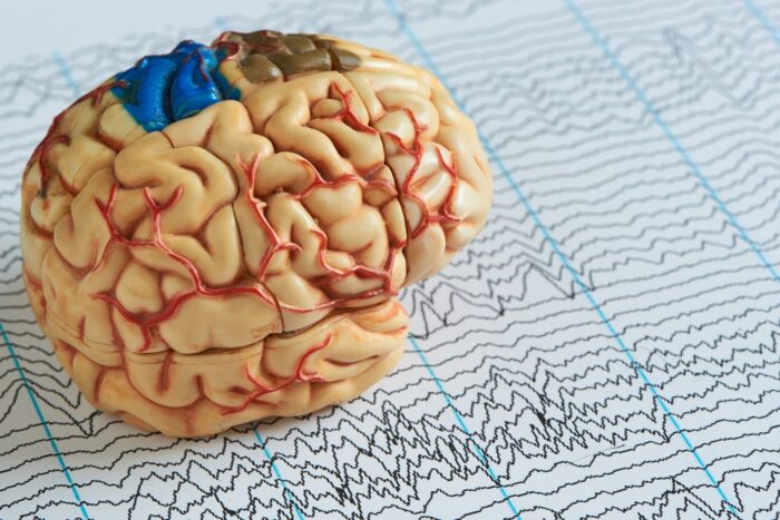 De ce să apelezi la brain mapping 3 beneficii majore