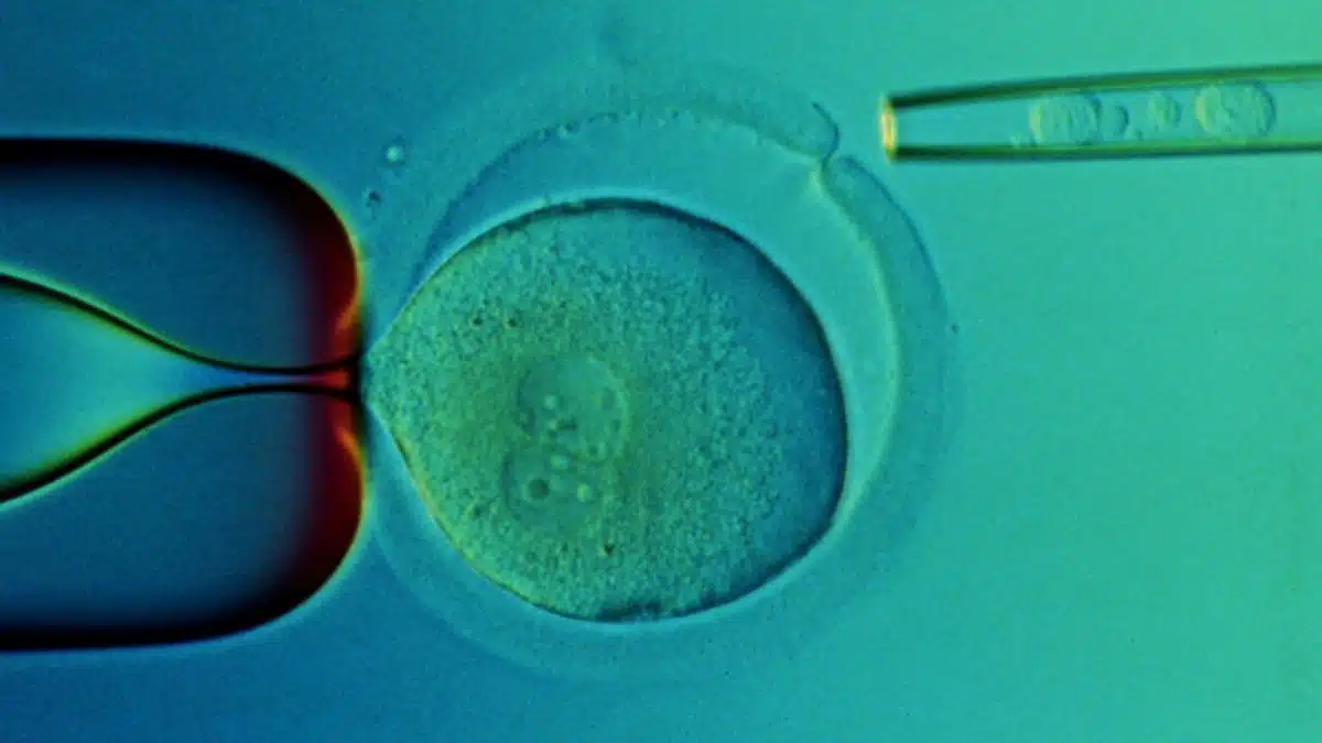 o-terapie-noua-cu-celule-stem-poate-repara-leziunile-oculare-ireversibile-si-orbitoare-arata-un-stud.webp