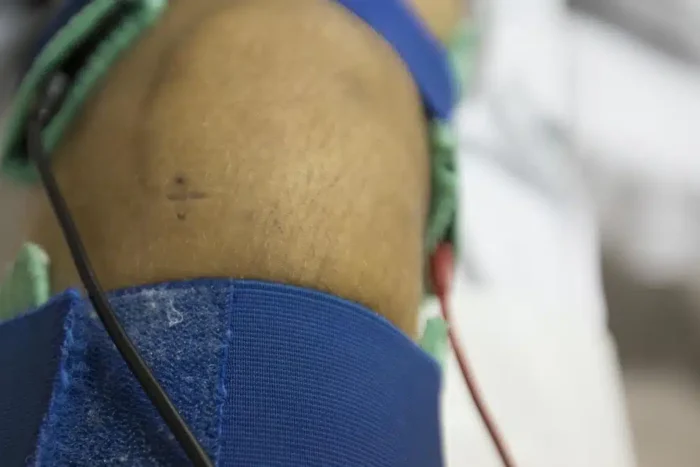 un baiat de 17 ani a inceput sa vorbeasca brusc o limba straina dupa o operatie la genunchi tanarul