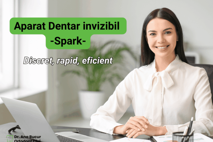 Aparat Dentar Invizibil Spark