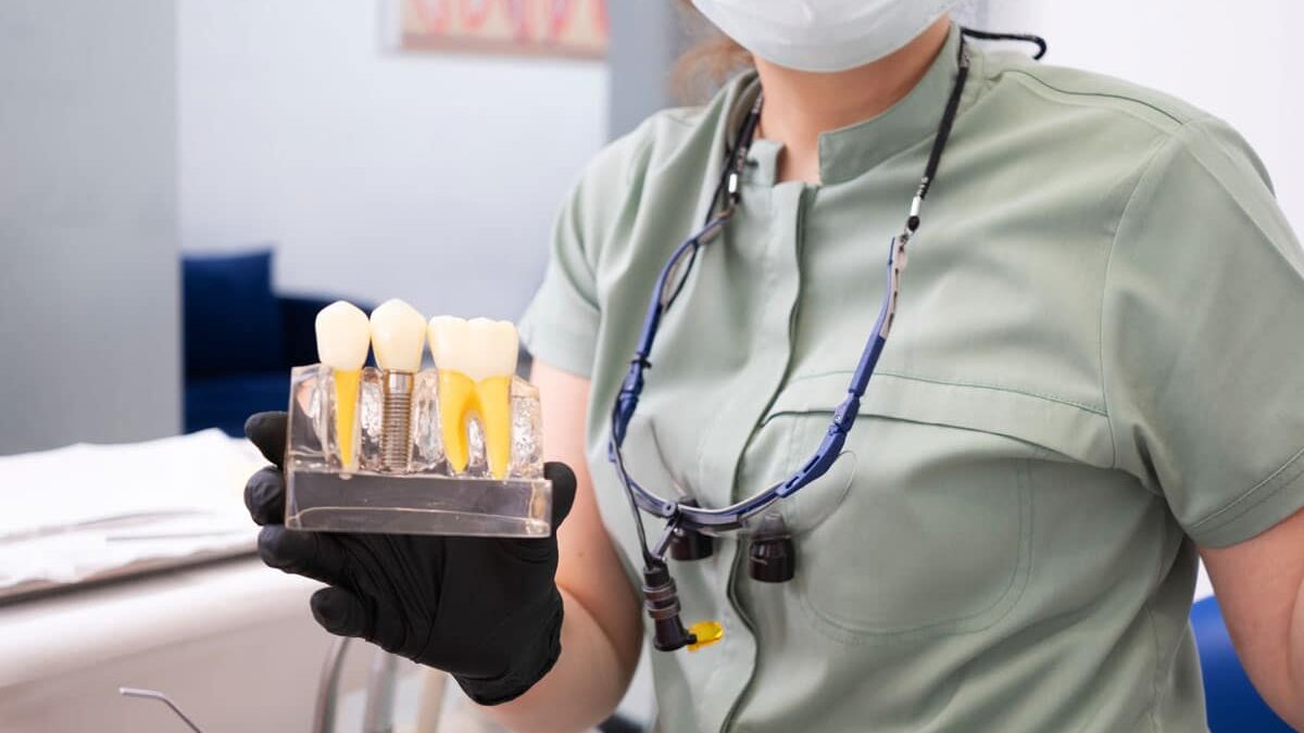 Factori care influențează prețul unui implant dentar pret implant dentar