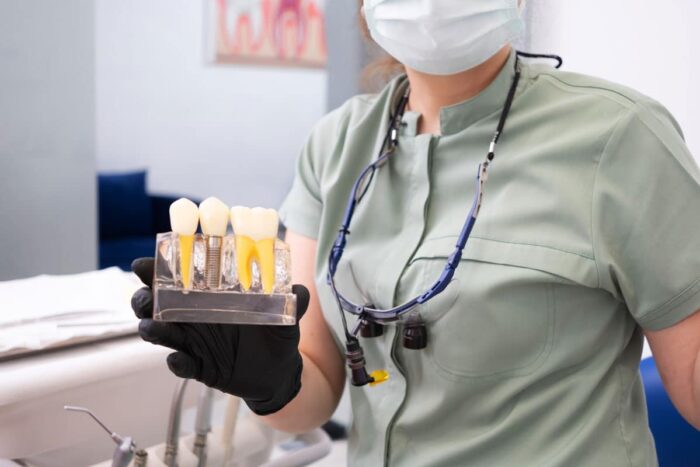 pret-implant-dentar