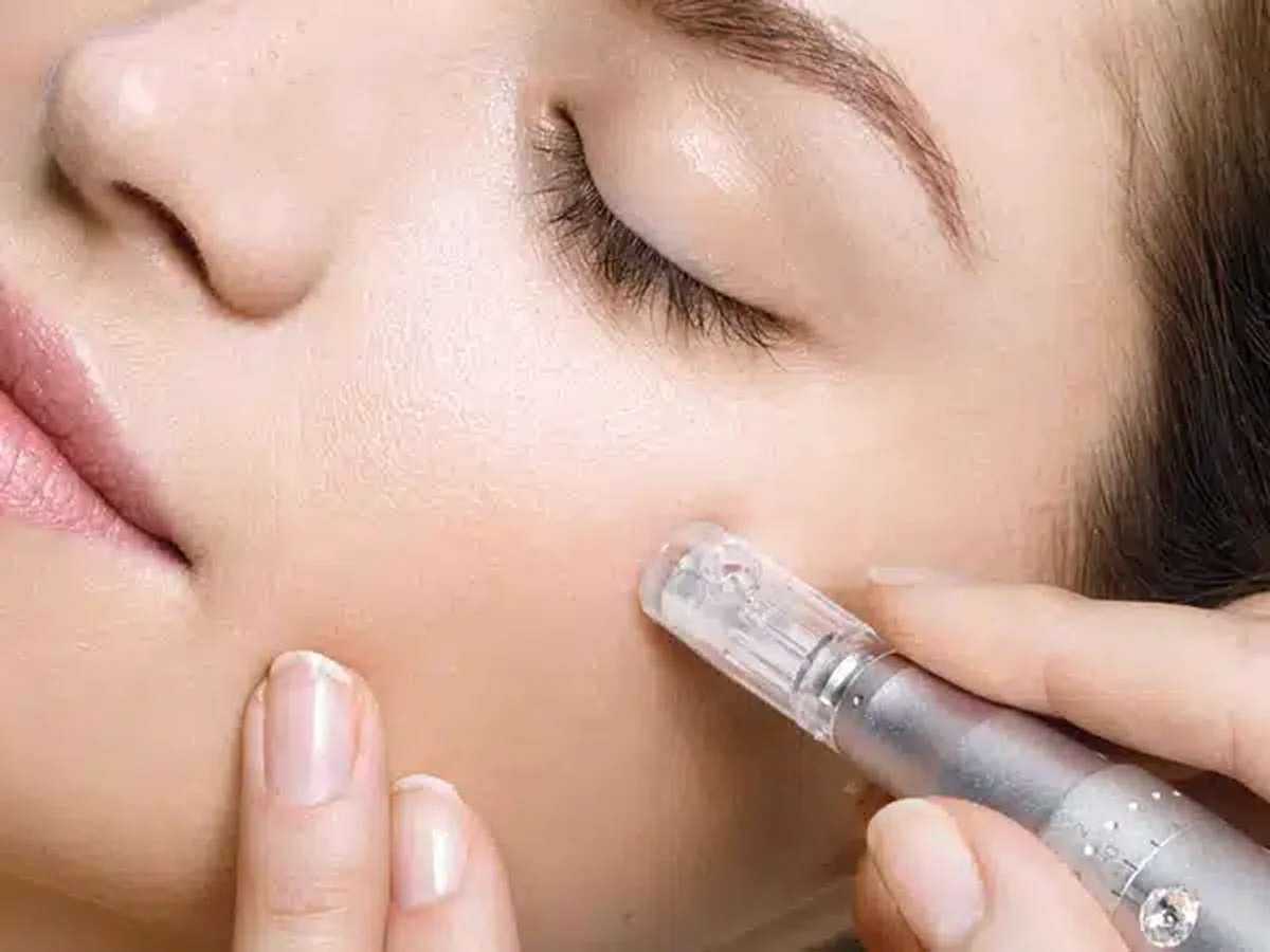 Procedura cu Microneedling este extrem de periculoasă  
Tot mai multe femei apelează la ea