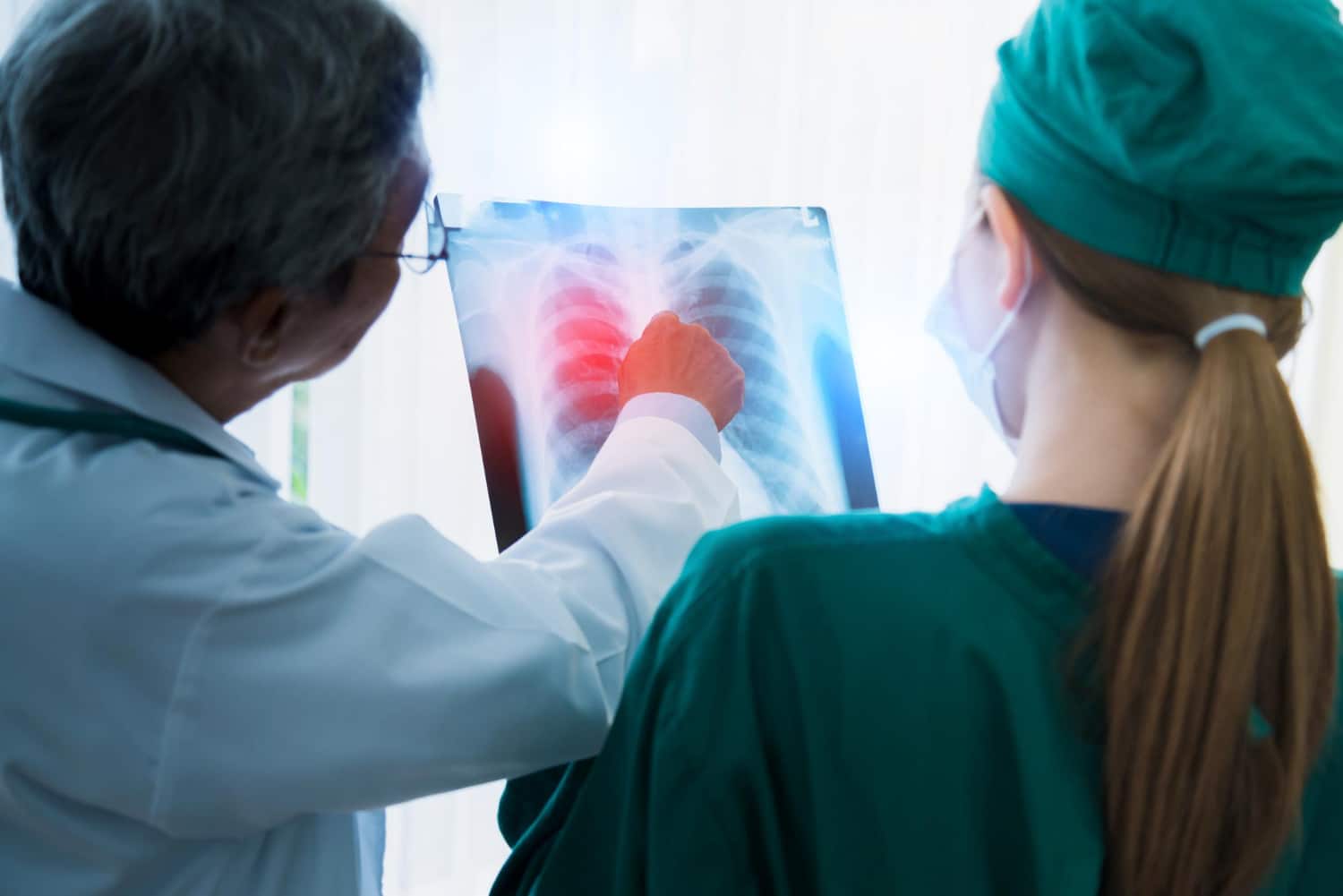 Care sunt rezultatele studiului LATIFY realizat de AstraZeneca pentru cancer pulmonar