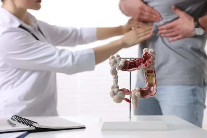 Cancerul-de-colon-creste-alarmant-la-tineri-din-cauza-bacteriilor.jpg
