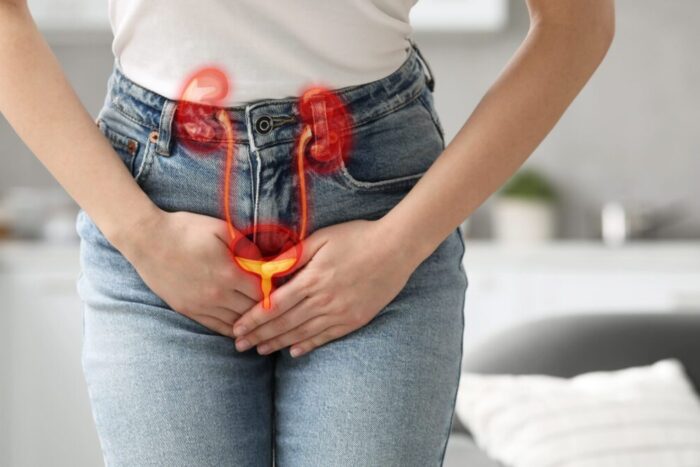 infectii urinare analize 1769698437
