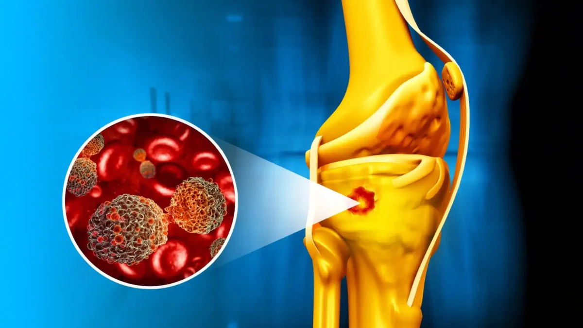 Nanoparticule Magnetice: O Nouă Strategie în Combaterea Cancerului Osos Descoperiri Promițătoare în Vindecarea Cancerului Osoasă cu Ajutorul Nanoparticulelor Magnetice nanoparticule magnetice lupta cu cancerul osos si ajuta la vindecare.webp