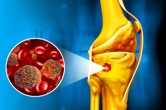 nanoparticule-magnetice-lupta-cu-cancerul-osos-si-ajuta-la-vindecare.webp.webp