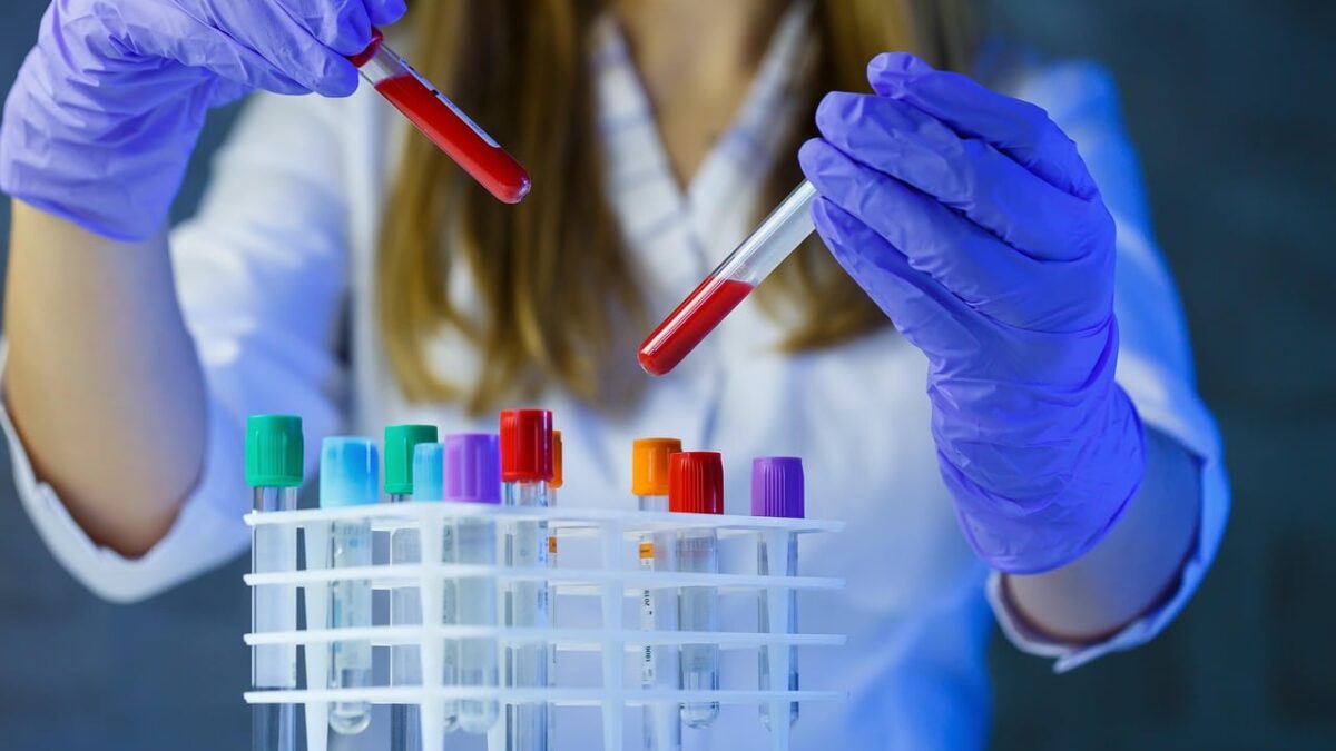 analize gratuite 2026 1773226109