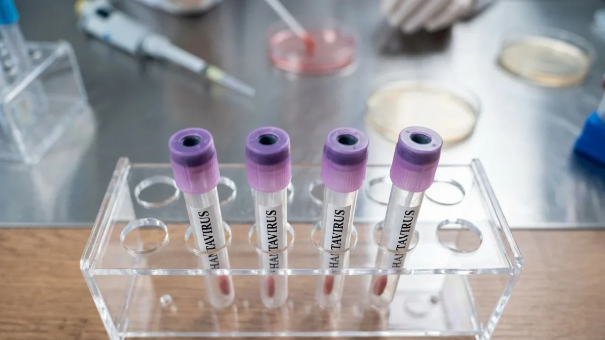 OMS pasageri hantavirus