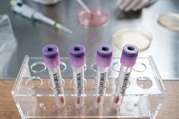 OMS pasageri hantavirus