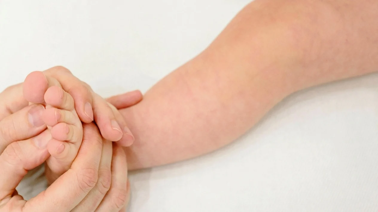 Milioane de pacienti. Ce ascund tratamentele clasice pentru dermatita