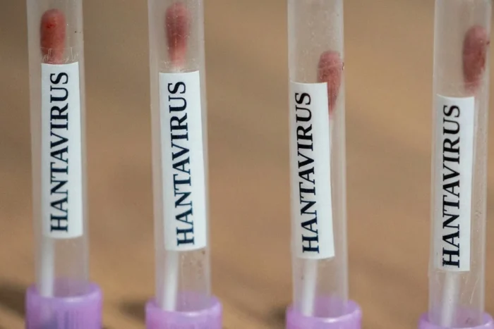 hantavirus