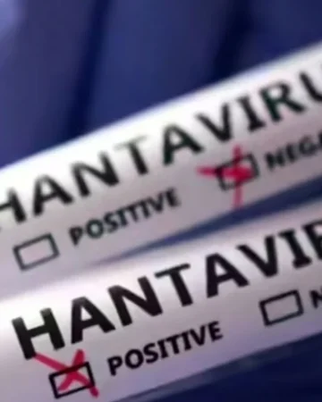 hantavirus