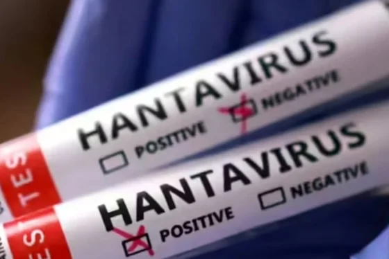 hantavirus