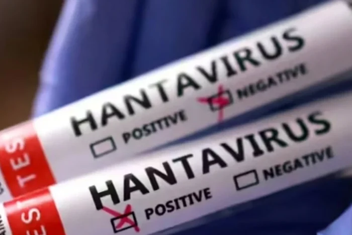 hantavirus