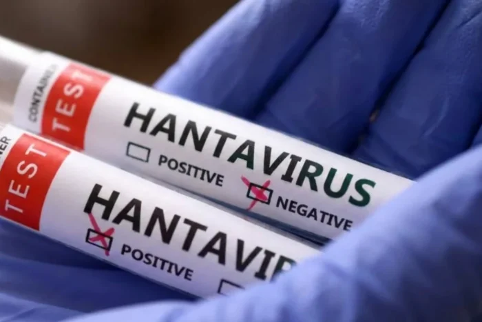 hantavirus