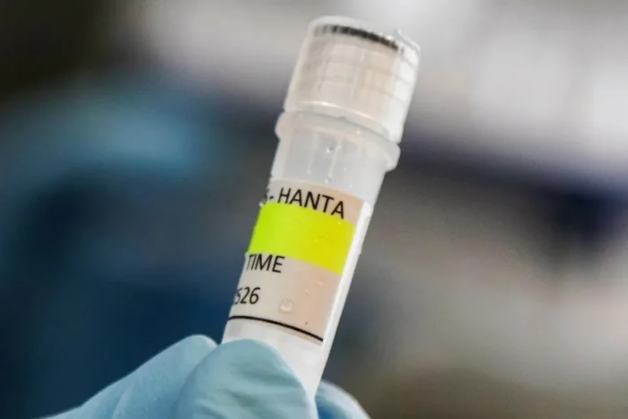 hantavirus Alicante