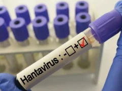 hantavirus nava de croaziera