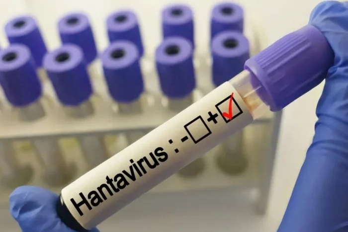hantavirus nava de croaziera