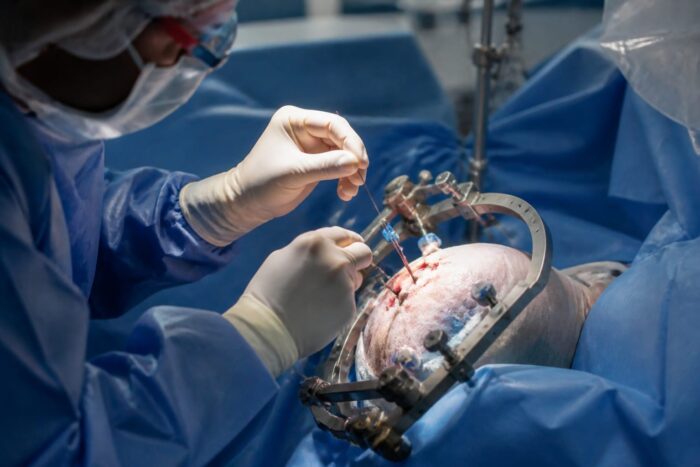 Paradromics a anunțat primul implant cerebral la om. Ce schimbă pasul făcut de rivala Neuralink Paradromics a anunțat primul implant cerebral la om. Ce schimbă pasul făcut de rivala Neuralink